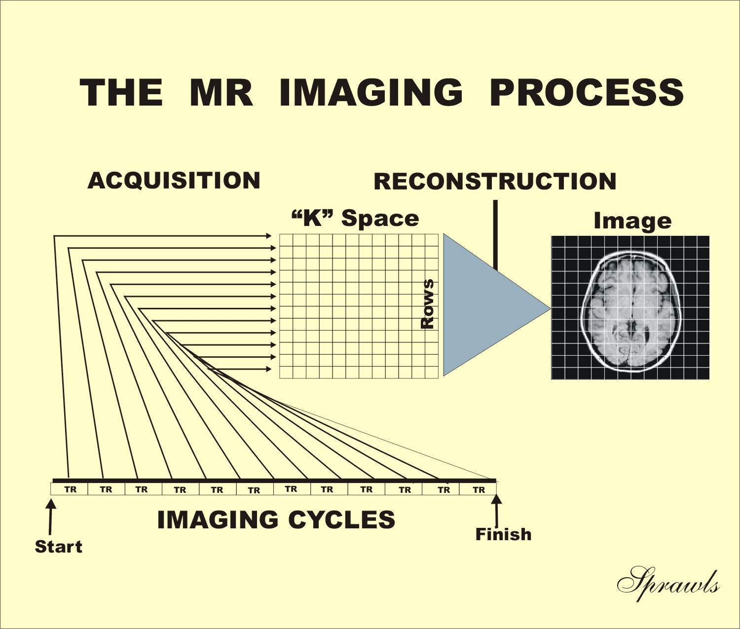 Resonance Imaging